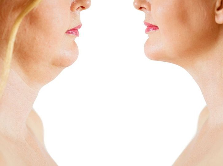 przyczyny starzenia się skóry szyi